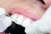Zobozdravnik nam lahko povrne samozavesten nasmeh ter boljšo samopodobo